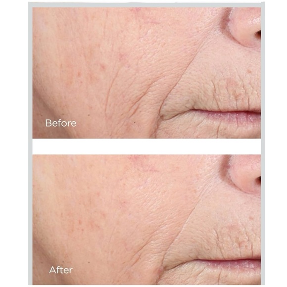 Perricone MD Vitamin C Ester CCC+ Ferulic Brightening Complex 20%, 2 fl. oz. - Picture 4 of 10